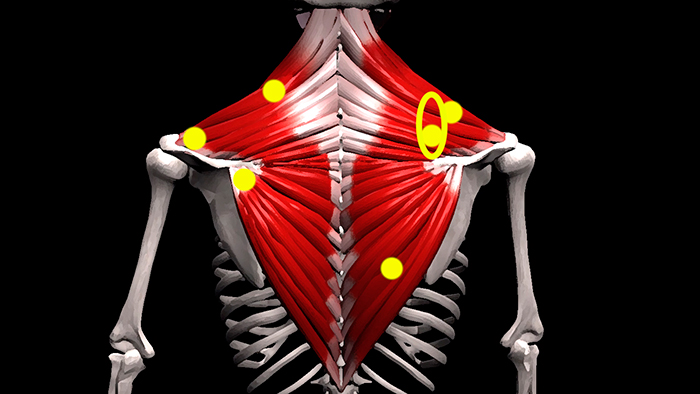 триггерные точки трапециевидной мышцы