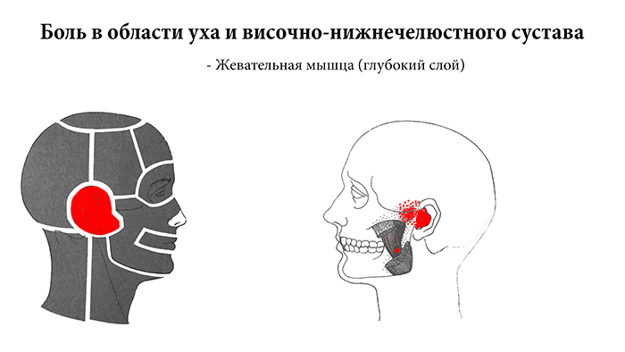 боль в области уха
